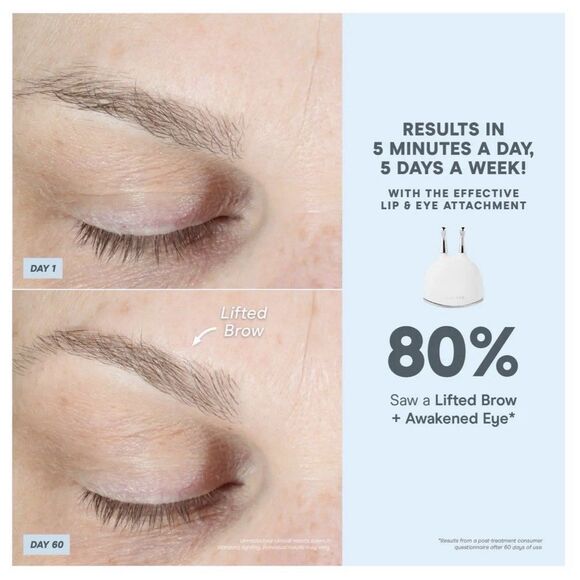 Nuface Trinity+ Boost w/ Effective Lip & Eye Attachment & Activator Gel - no box - Picture 8 of 8